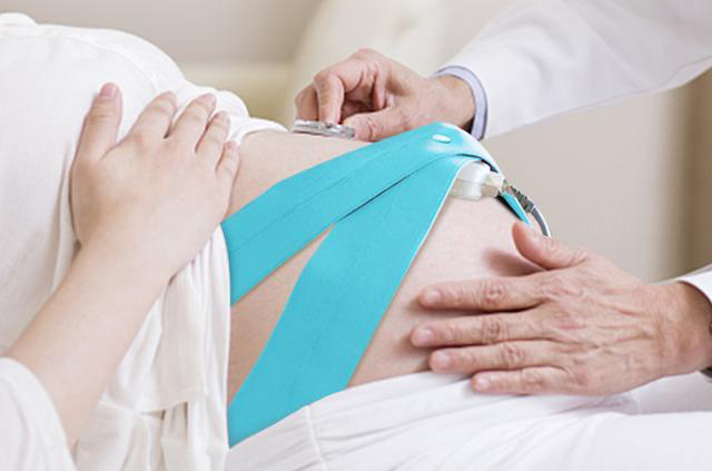 Fetal Heart Monitor Tape